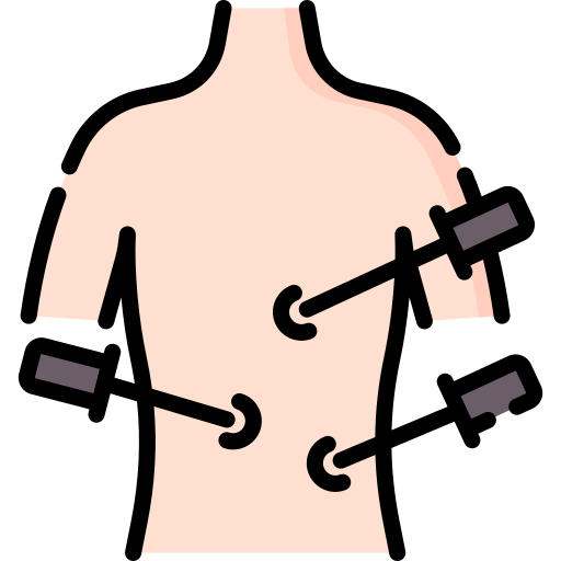 Laparoscopic Surgery